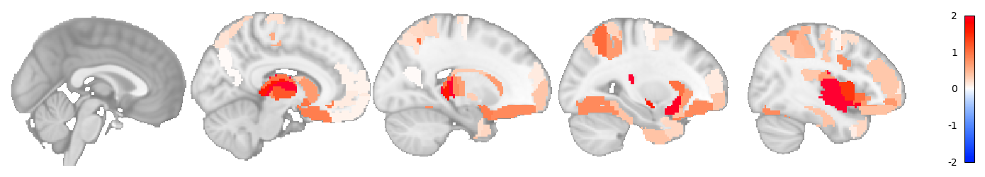 ../../../../_images/tutorials_notebooks_translation_optogenetic_annotation_optogenetic_circuits_14_1.png